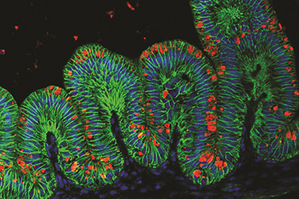Ученые впервые вырастили искусственные желудки
