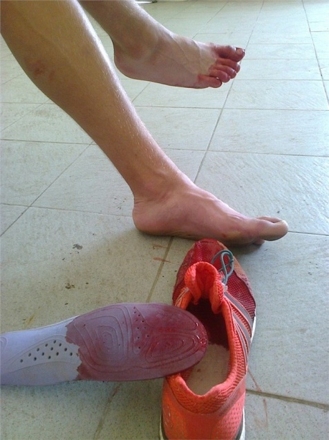 Красноярский триатлонист преодолел дистанцию Кубка России с пропоротой ногой