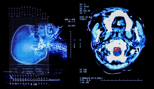 Опасно ли делать рентген?