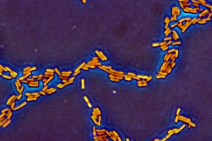 В США разразилась загадочная эпидемия