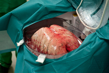 Найден способ спасения от смертоносной болезни легких