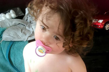 Мать заметила необычный наклон головы дочери и спасла ее от рака