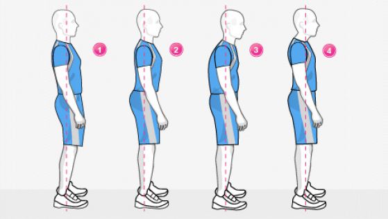 ТИПЫ НАРУШЕНИЯ ОСАНКИ