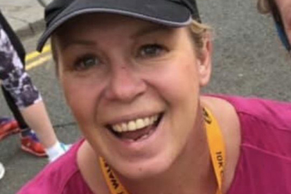 Укус ядовитого паука проделал дыру в руке женщины