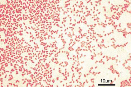 Найдено простое средство против смертельных болезней