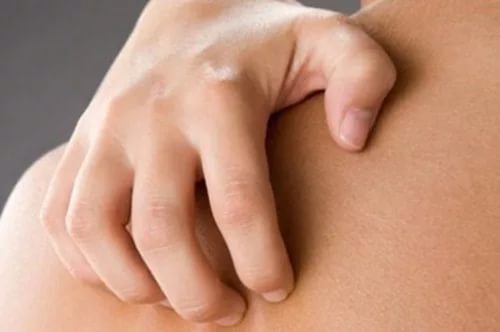 Откуда берутся расчесы на коже и как их лечить?