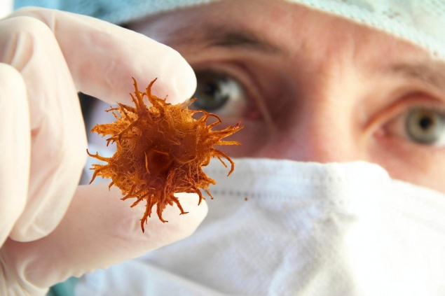 В Красноярском крае выросло количество больных раком