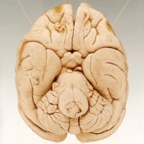 Найдена отвечающая за уникальность человеческого разума зона мозга