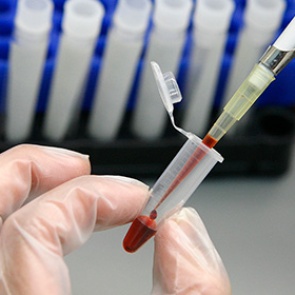 Медики научились предсказывать смерть здоровых людей от будущих инфекций