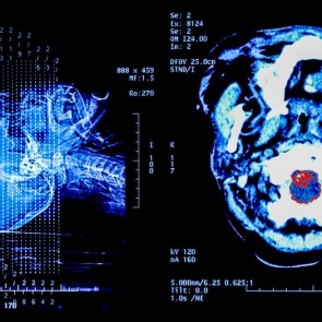 Опасно ли делать рентген?