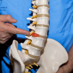 ЛЕЧЕНИЕ МЕЖПОЗВОНОЧНОЙ ГРЫЖИ