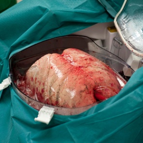 Найден способ спасения от смертоносной болезни легких