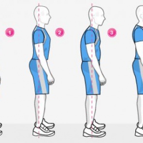 ТИПЫ НАРУШЕНИЯ ОСАНКИ