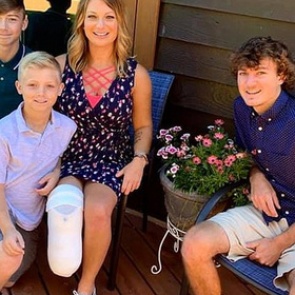 Женщина споткнулась о собаку и лишилась всех пальцев