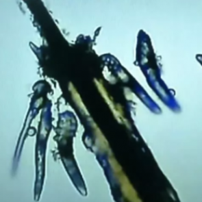 Женщина плохо умывалась и расплодила на глазах полчища паразитов