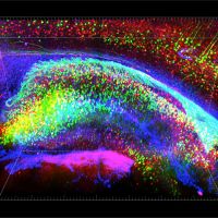 Ученые сделали мозг прозрачным при помощи сахарного сиропа